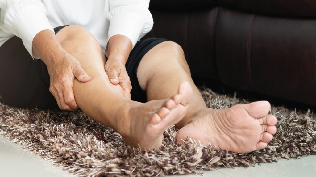 ¿Es recomendable tomar medicamentos para las varices?