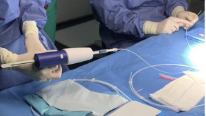 Operación Vascular Mínimamente Invasiva