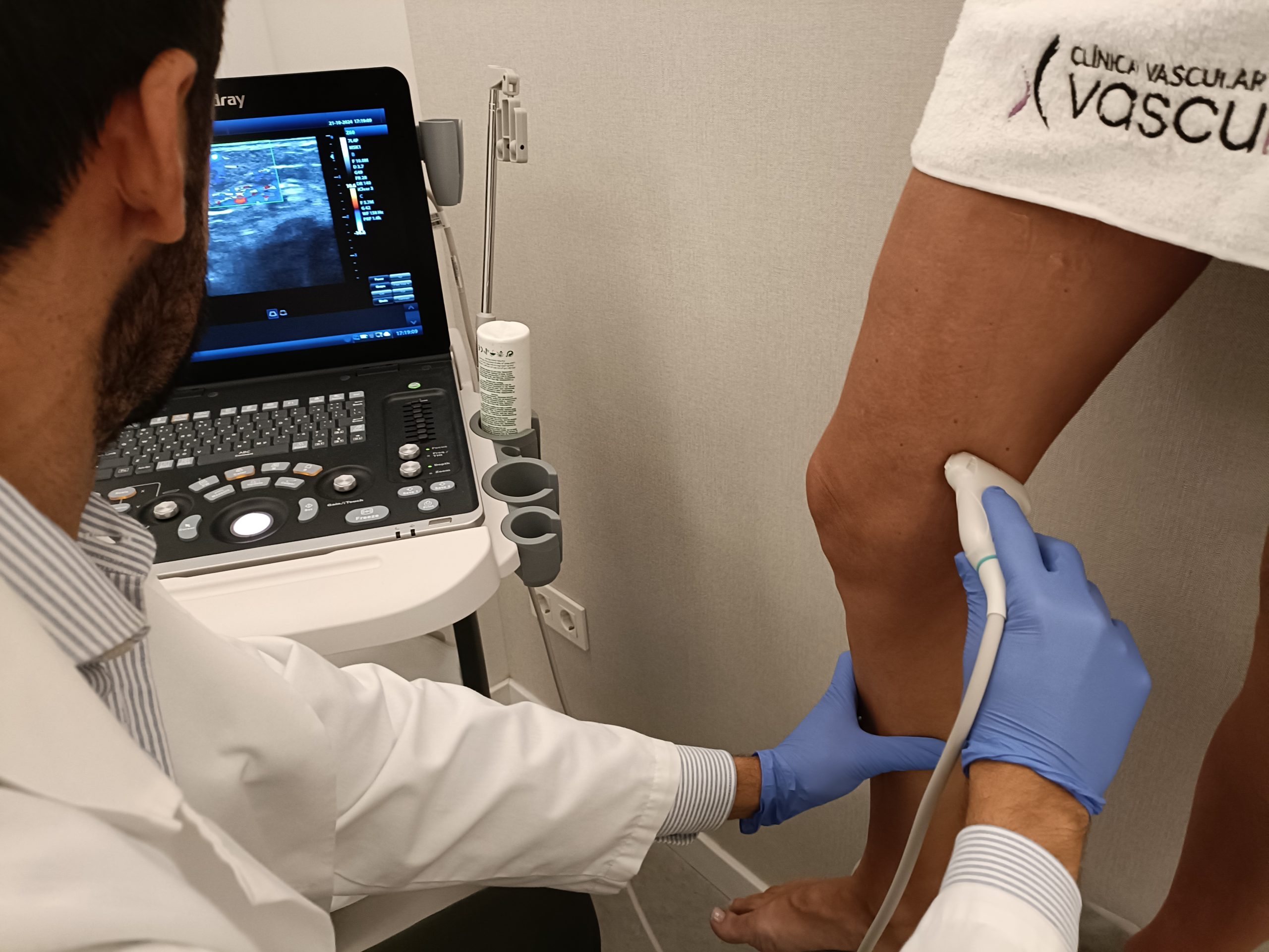 Cabecera varices gruesas 1