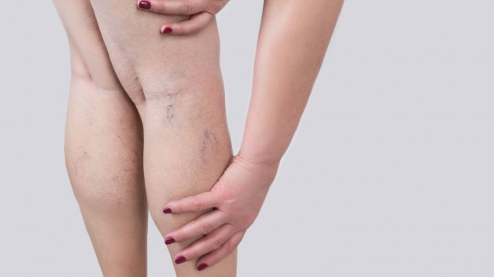 Por qué las mujeres son más propensas a la mala circulación en las piernas  que los hombres? Le contamos detalles