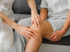 Edemas en las piernas: Causas, tratamientos y consejos